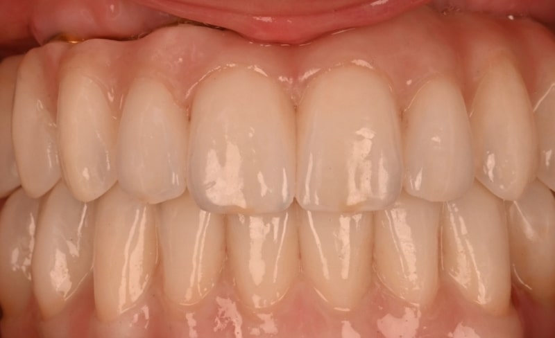 After -Bromsgrove Dental