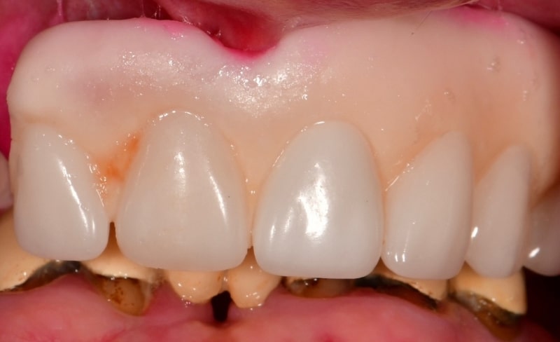 Before - Bromsgrove Dental