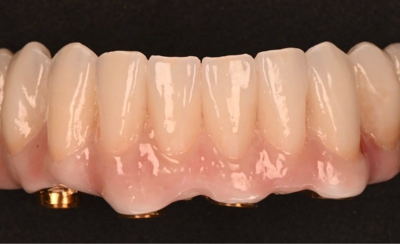 After -Bromsgrove Dental