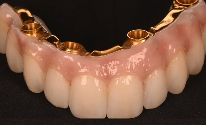 Before - Bromsgrove Dental