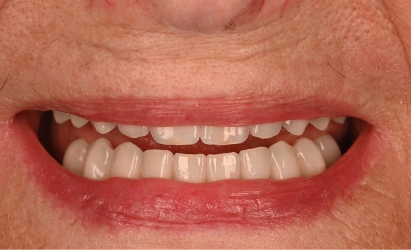 After -Bromsgrove Dental