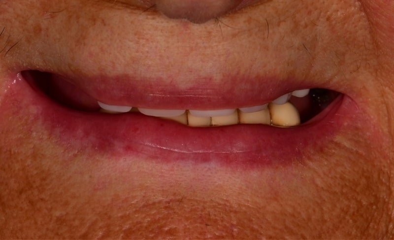 Before - Bromsgrove Dental