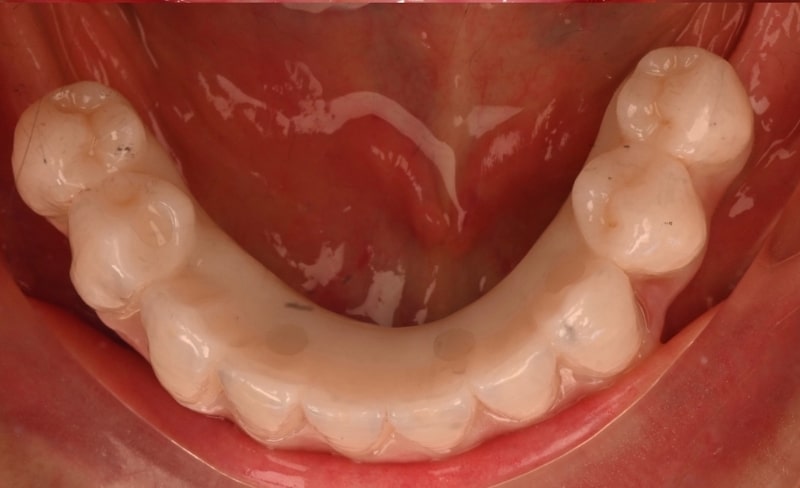 After -Bromsgrove Dental