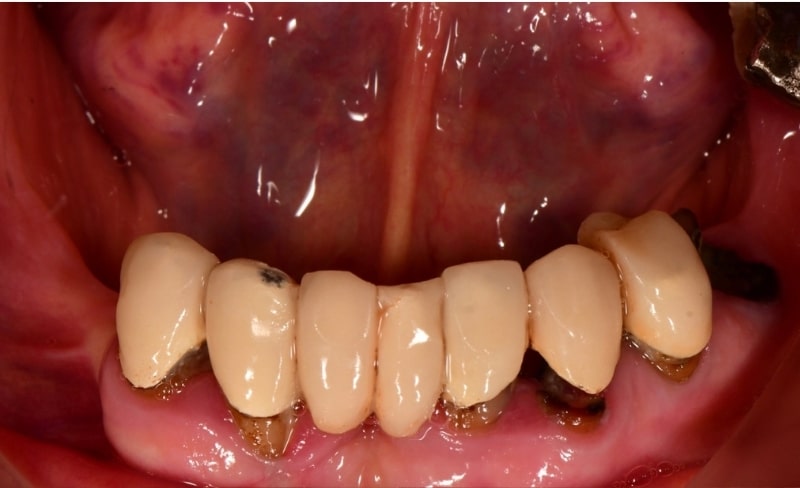 Before - Bromsgrove Dental