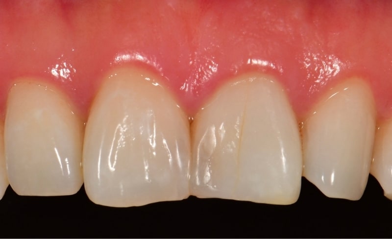 After -Bromsgrove Dental