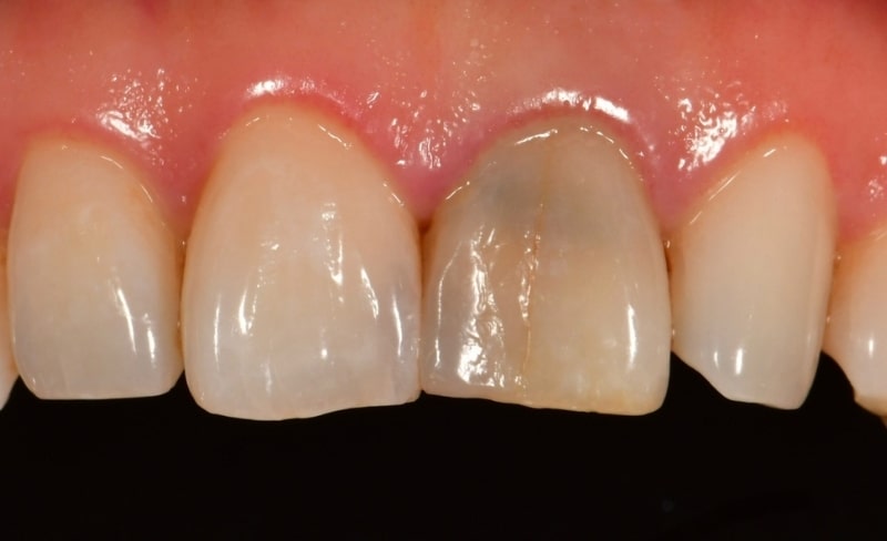 Before - Bromsgrove Dental