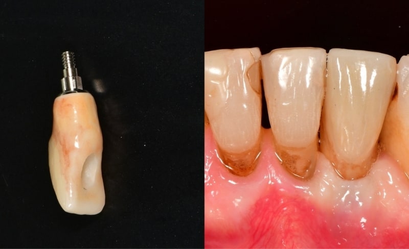 After -Bromsgrove Dental