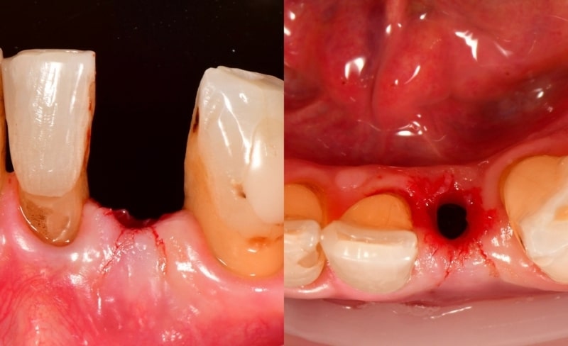 Before - Bromsgrove Dental