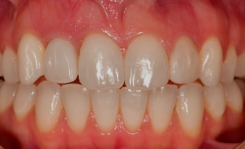 After -Bromsgrove Dental