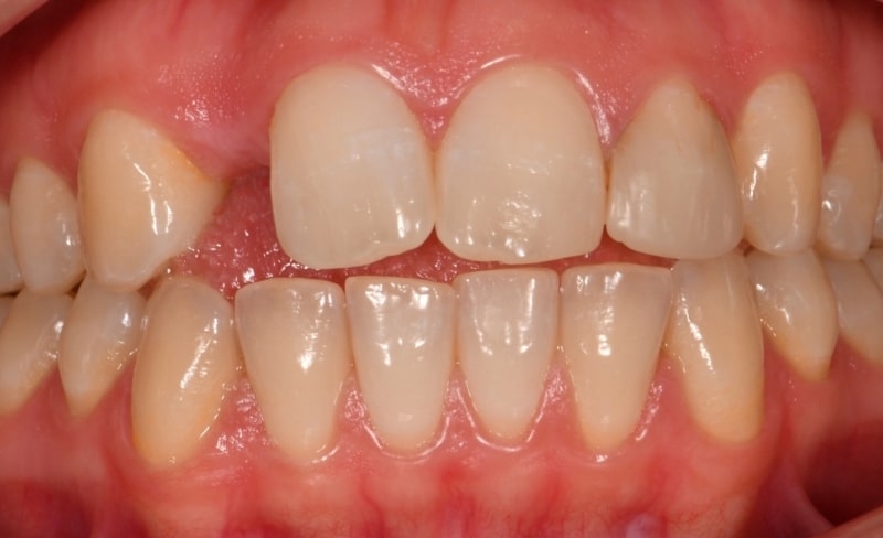Before - Bromsgrove Dental