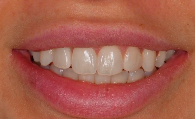 After -Bromsgrove Dental