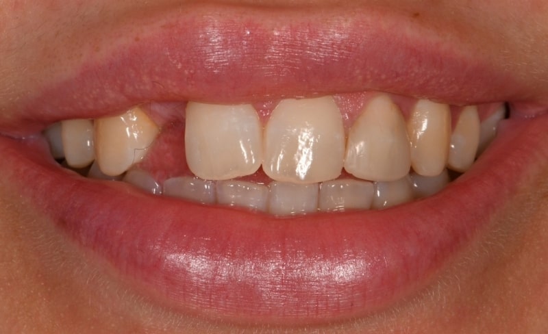 Before - Bromsgrove Dental