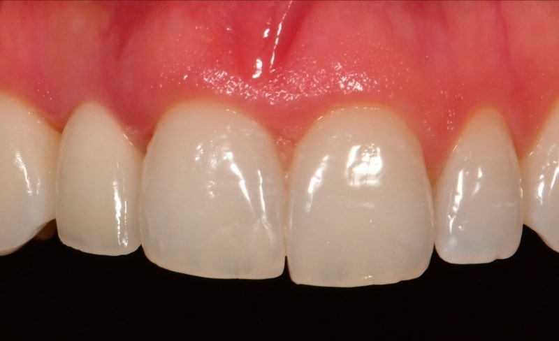 After -Bromsgrove Dental