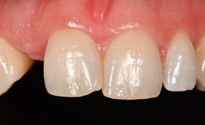 Before - Bromsgrove Dental