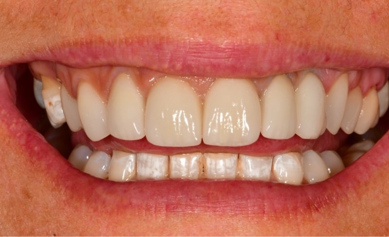 After -Bromsgrove Dental
