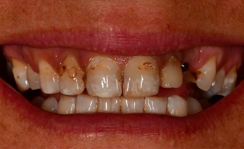 Before - Bromsgrove Dental