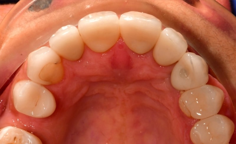 After -Bromsgrove Dental