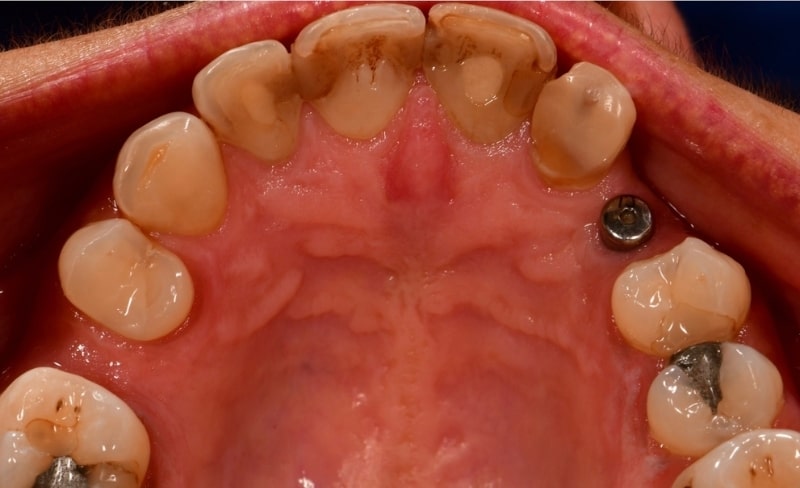 Before - Bromsgrove Dental