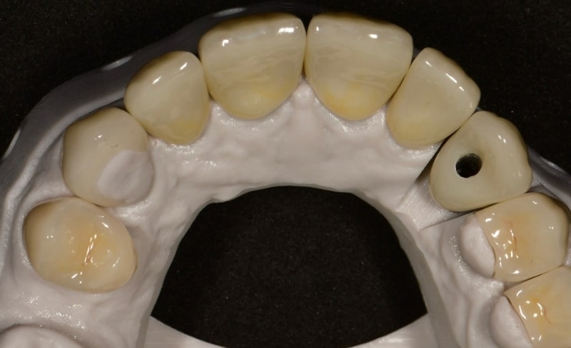 After -Bromsgrove Dental