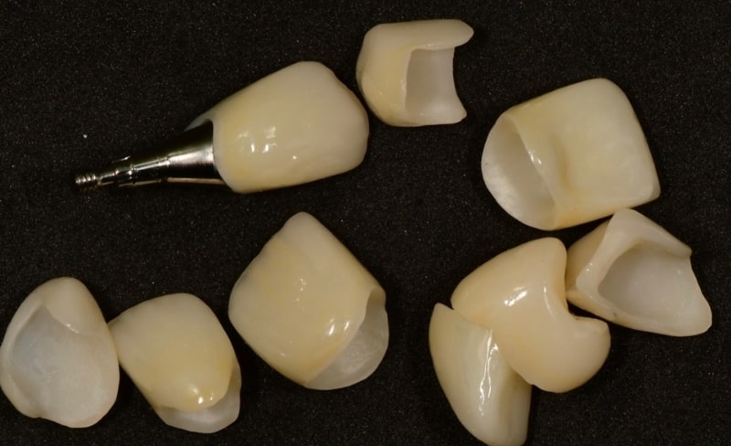 Before - Bromsgrove Dental