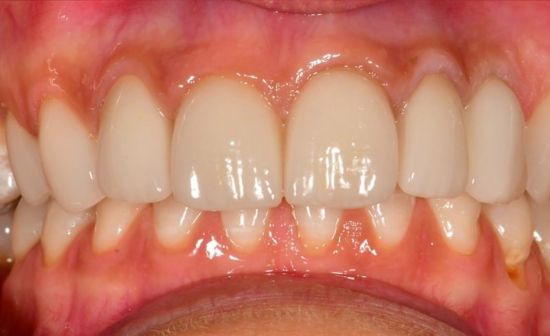 After -Bromsgrove Dental