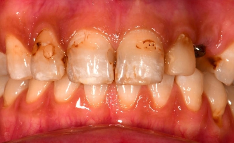 Before - Bromsgrove Dental