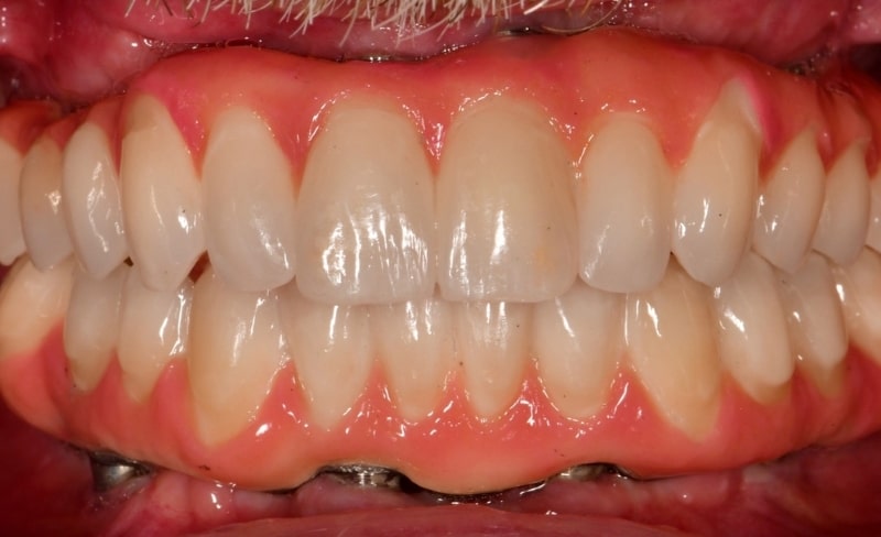 After -Bromsgrove Dental