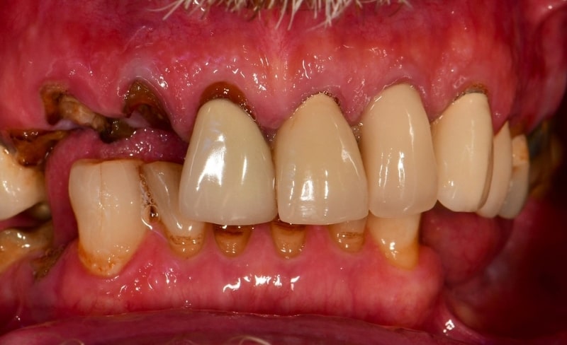 Before - Bromsgrove Dental