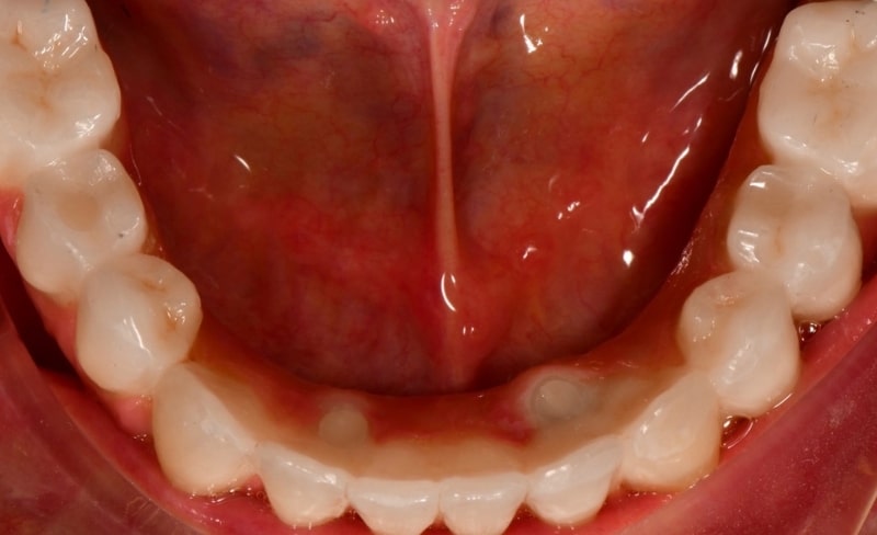 After -Bromsgrove Dental