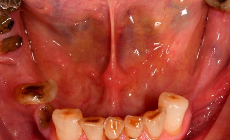 Before - Bromsgrove Dental