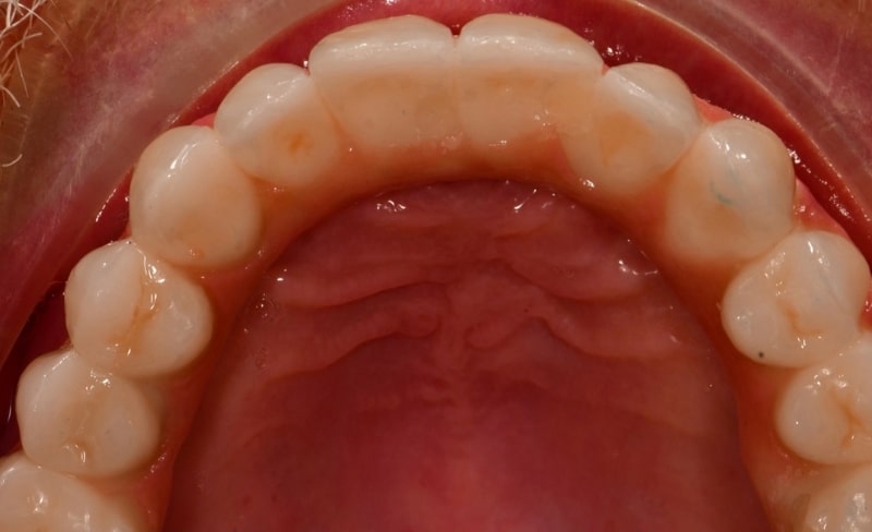 After -Bromsgrove Dental