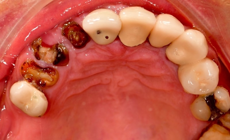 Before - Bromsgrove Dental