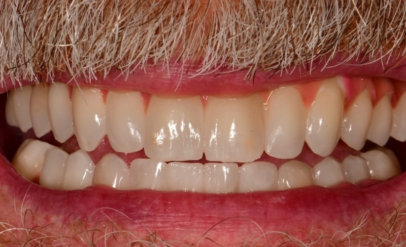 After -Bromsgrove Dental