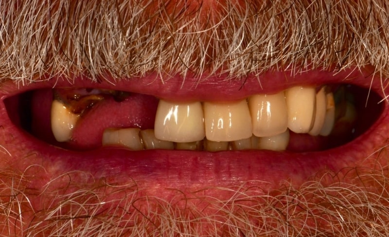 Before - Bromsgrove Dental