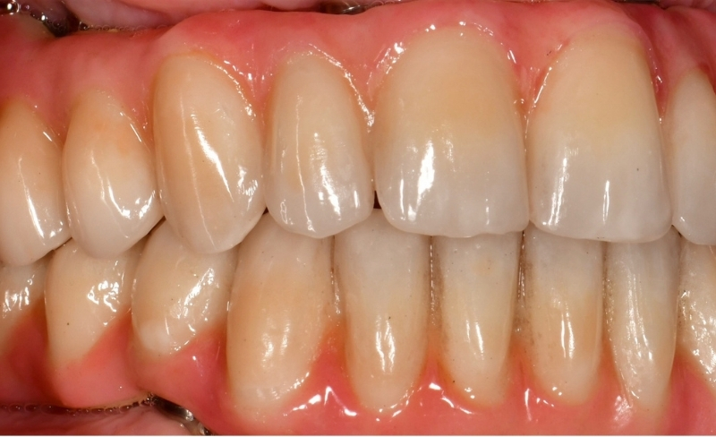 After -Bromsgrove Dental