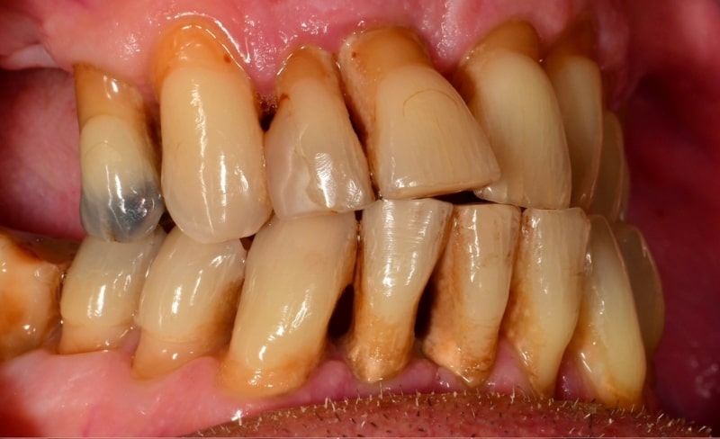 Before - Bromsgrove Dental