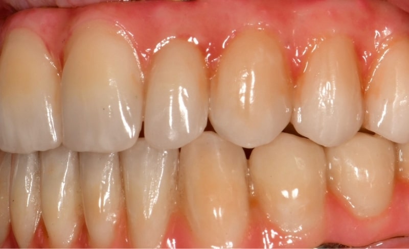 After -Bromsgrove Dental