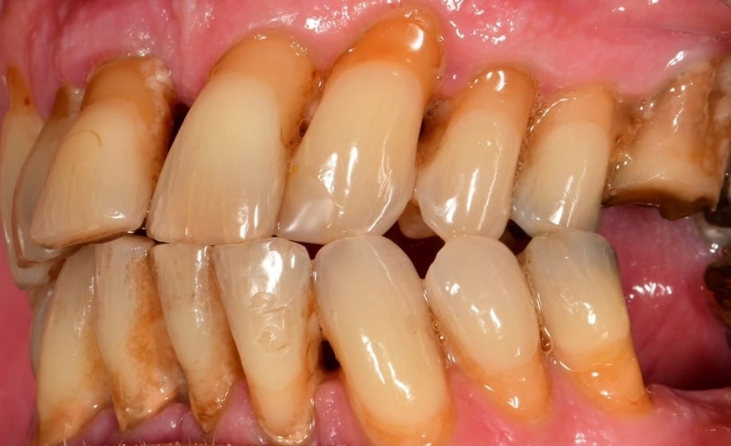 Before - Bromsgrove Dental