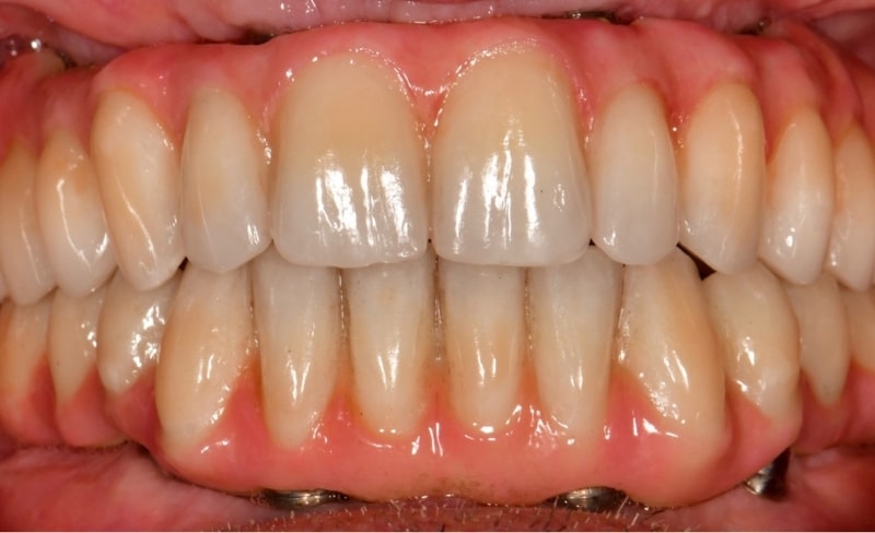 After -Bromsgrove Dental