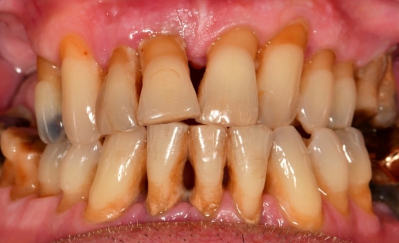 Before - Bromsgrove Dental