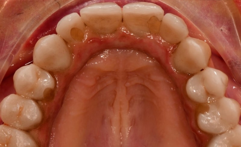 After -Bromsgrove Dental