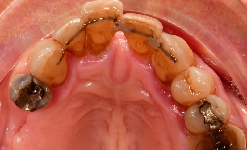 Before - Bromsgrove Dental