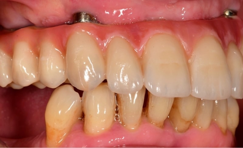 After -Bromsgrove Dental