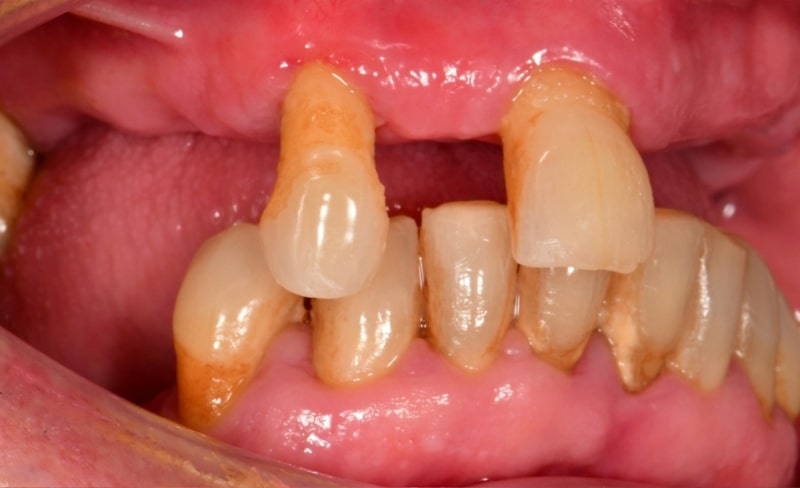 Before - Bromsgrove Dental