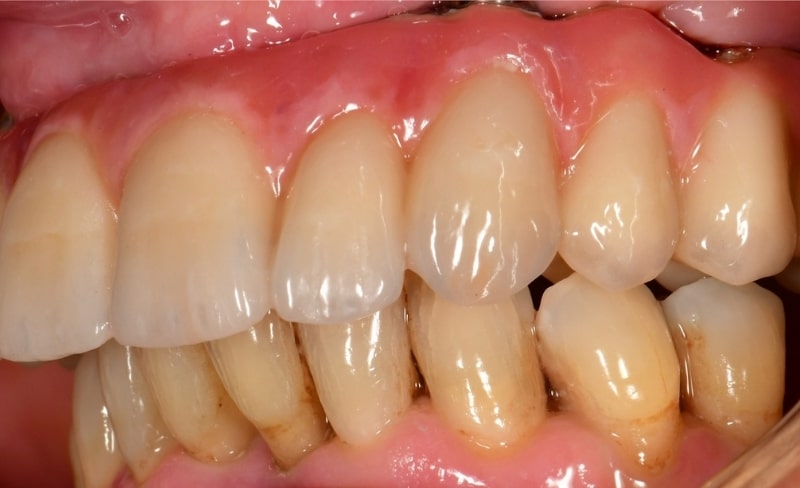 After -Bromsgrove Dental