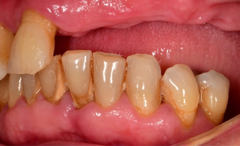 Before - Bromsgrove Dental