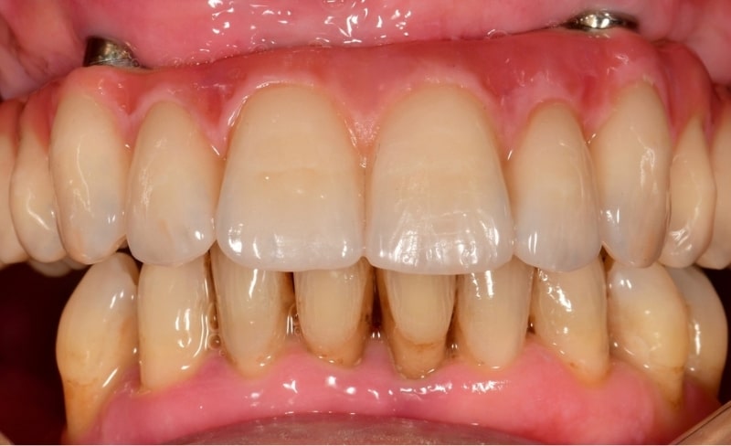 After -Bromsgrove Dental