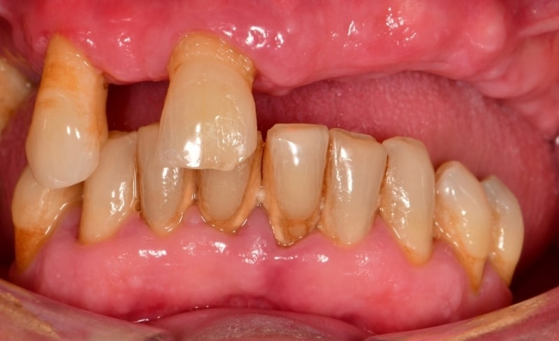 Before - Bromsgrove Dental