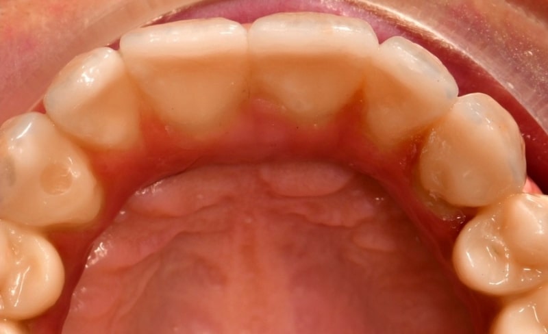 After -Bromsgrove Dental