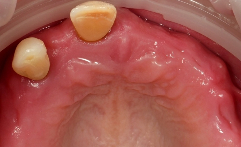 Before - Bromsgrove Dental